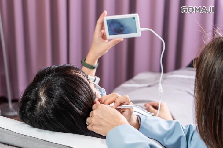 耳道內窺鏡檢查