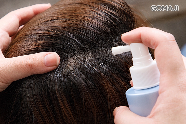  毛囊清潔淨化液處理