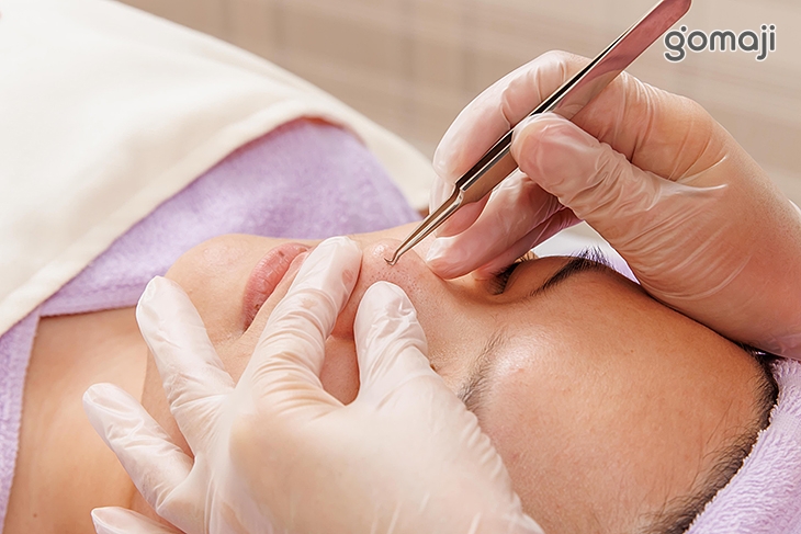 毛孔清潔手工清粉刺