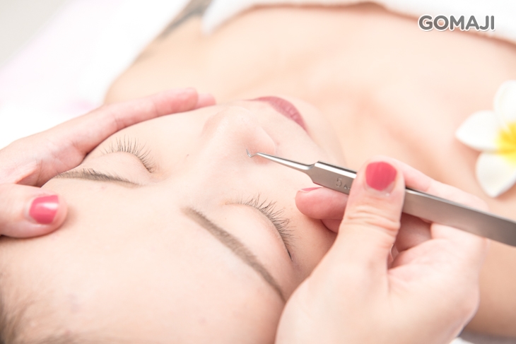 手工清粉刺全臉20分(黑頭粉刺淨化清除，視膚況而定)