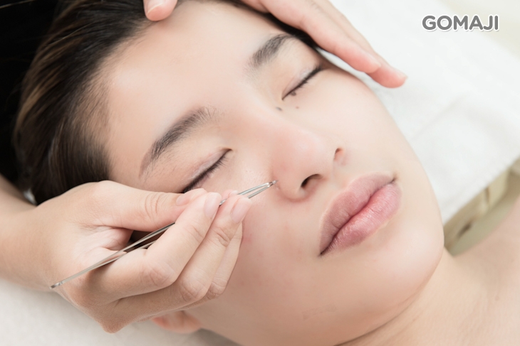 手工清粉刺全臉(黑頭粉刺淨化清除，視個人膚況而定)