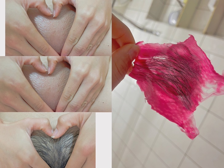 私密處除毛