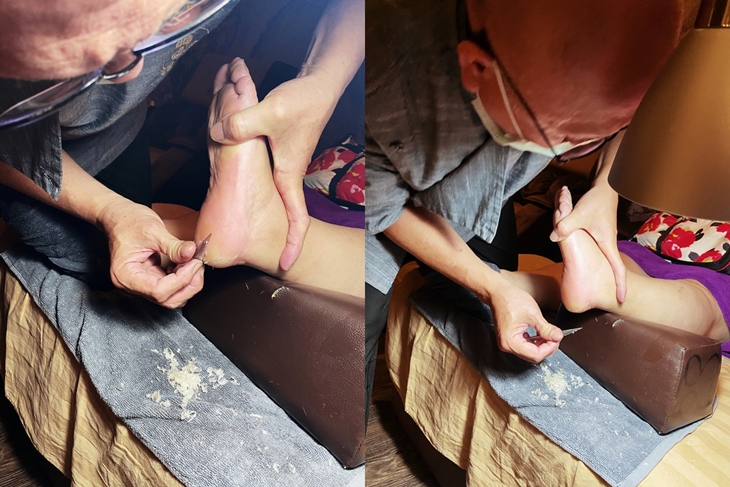 專業修厚繭腳皮雞眼