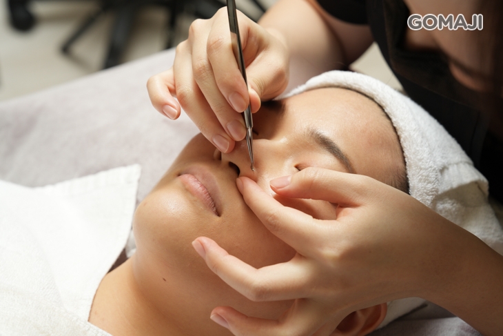 粉刺淨化清潔處理