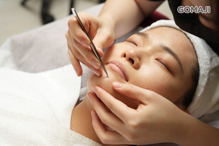 粉刺淨化清潔處理