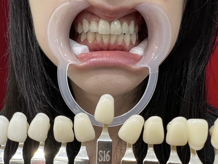 比對使用前色階