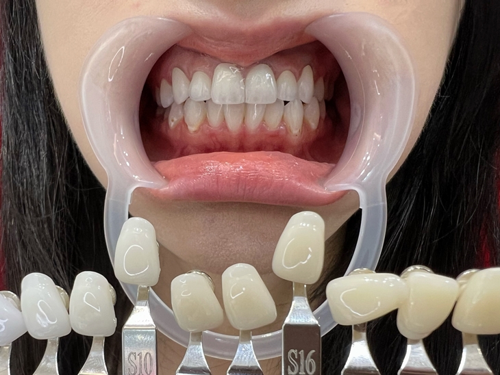 比對使用後色階