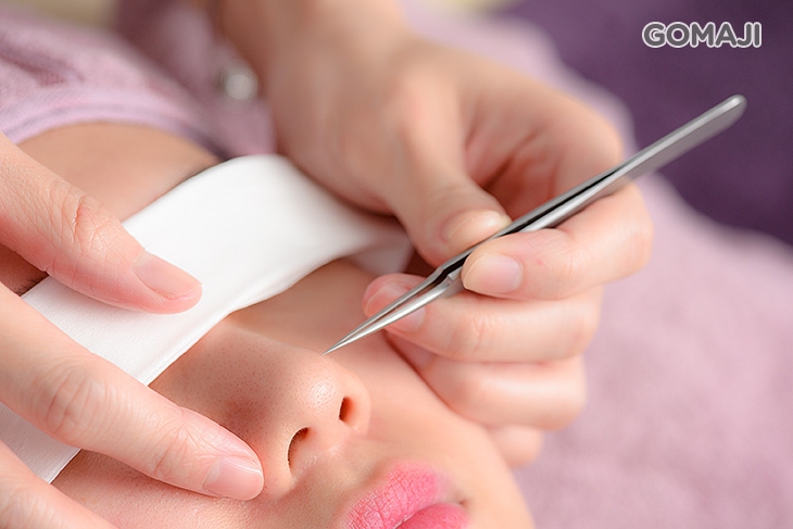 粉刺痘痘手工淨化調理