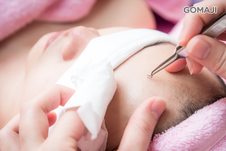 粉刺調理(手工)