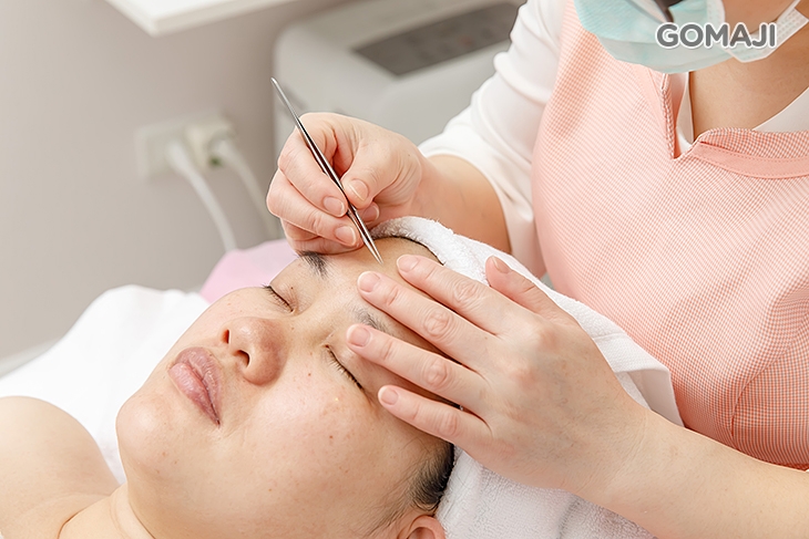 全臉黑頭粉刺痘痘淨化清除