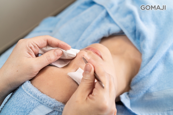 粉刺痘痘清潔調理