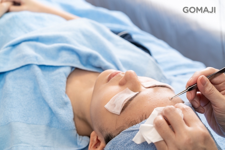 粉刺痘痘清潔調理