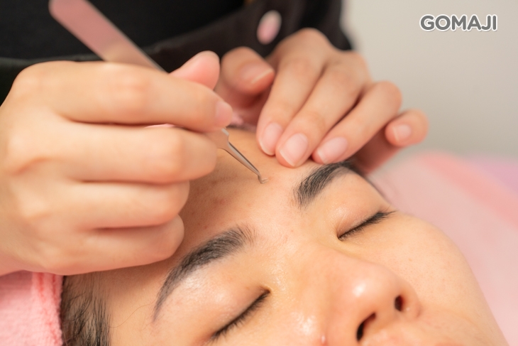 手工粉刺痘痘調理