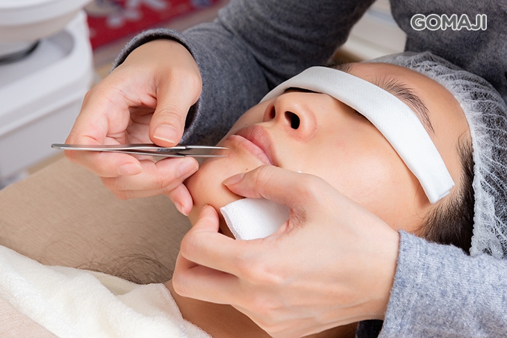 全臉手工痘痘粉刺內胞處理