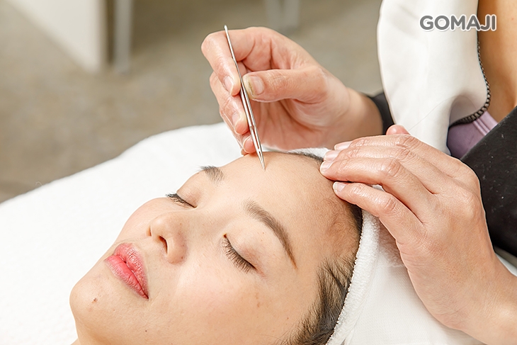 毛孔淨化痘痘粉刺清潔