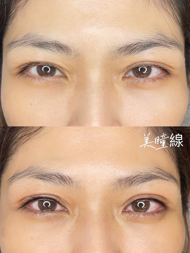 半永久隱型美瞳線