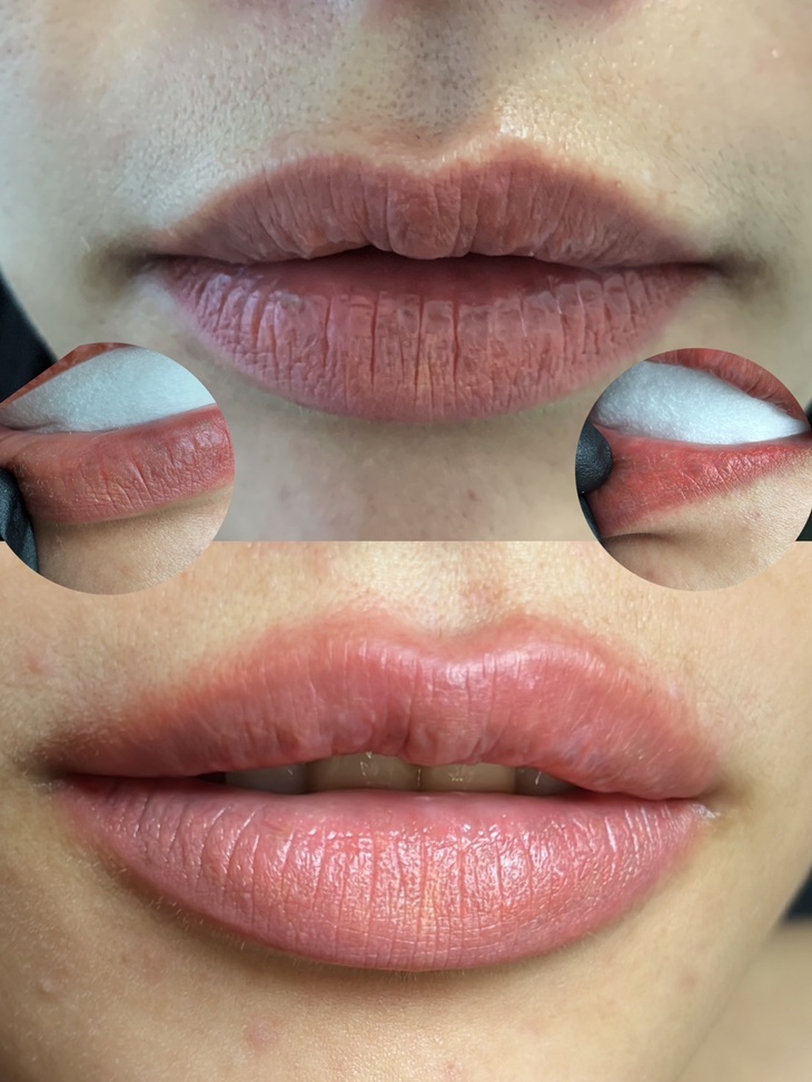 嘴唇黑、唇色暗沉矯正唇色課程