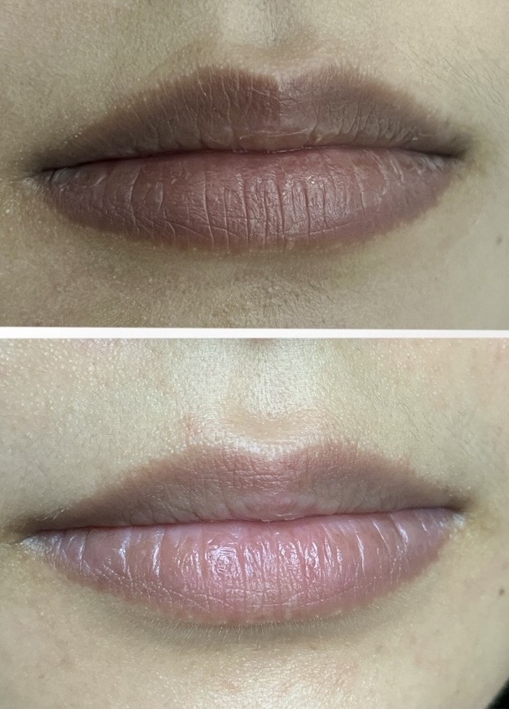 嘴唇黑、唇色暗沉矯正唇色課程