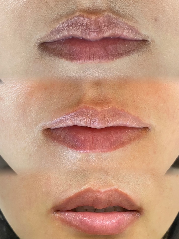 嘴唇黑、唇色暗沉矯正唇色課程