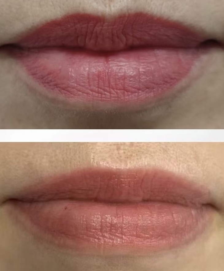 嘴唇黑、唇色暗沉矯正唇色課程