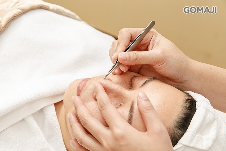 打擊黑頭粉刺淨化護理