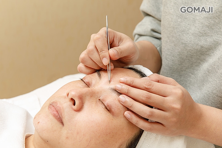 打擊黑頭粉刺淨化護理