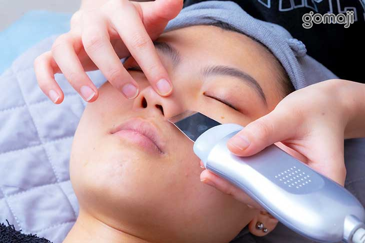 水飛梭去角質(淨化毛孔、粉刺、痘痘)