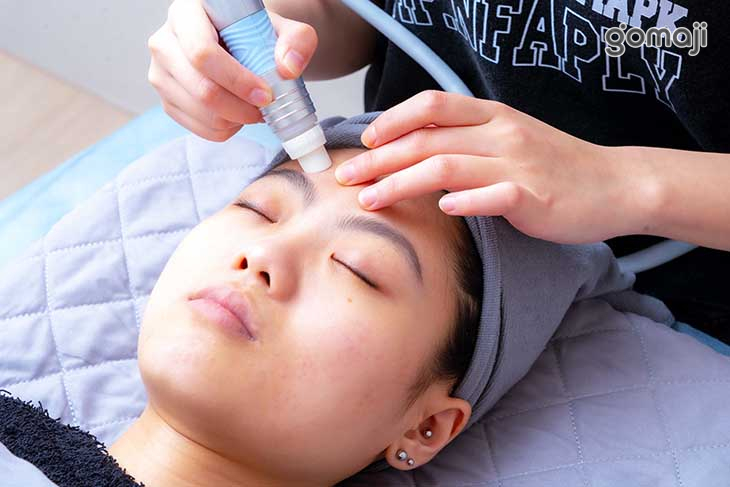 水飛梭去角質(淨化毛孔、粉刺、痘痘)