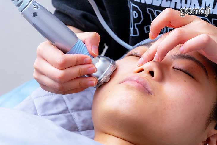 水飛梭去角質(淨化毛孔、粉刺、痘痘)