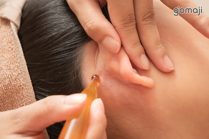 外泌體導入耳周按摩調理