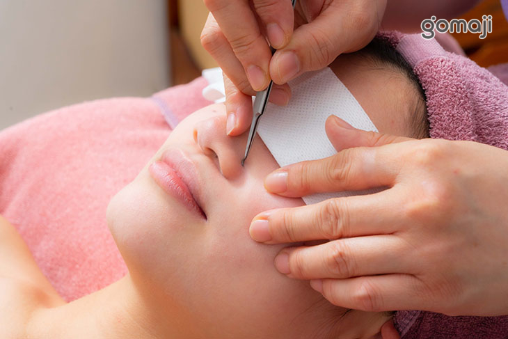 專業手工清粉刺