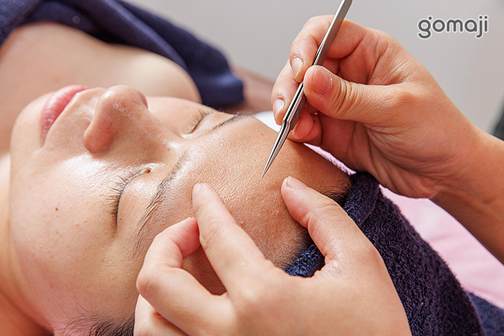 粉刺痘痘清潔調理