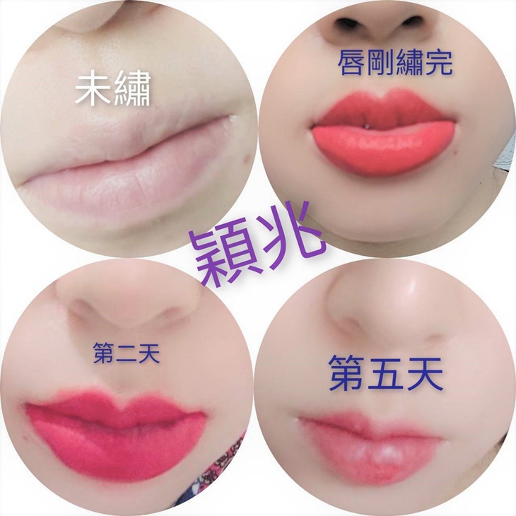 永久嘟嘟粉嫩美唇