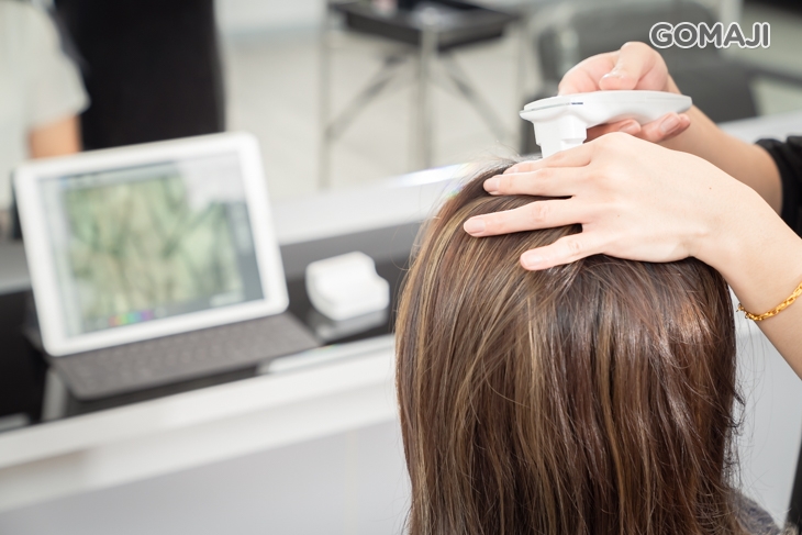 頭皮檢測 