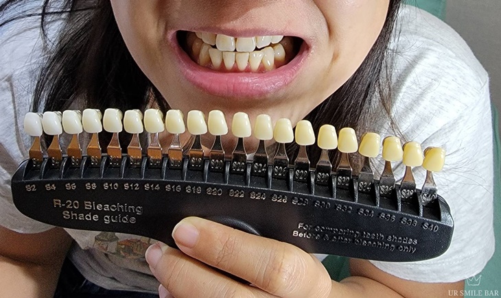 UR Smile Bar