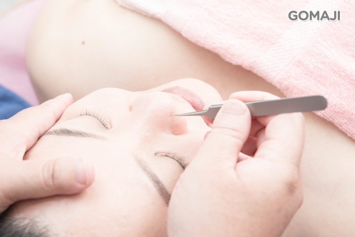 清除痘痘黑頭內包粉刺淨化