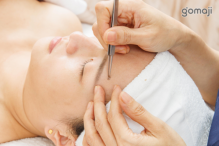 毛孔淨化粉刺清潔(依個人膚況而定)