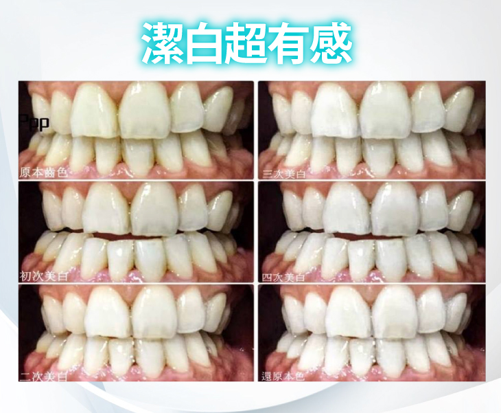 美齒去漬清汙亮白護理