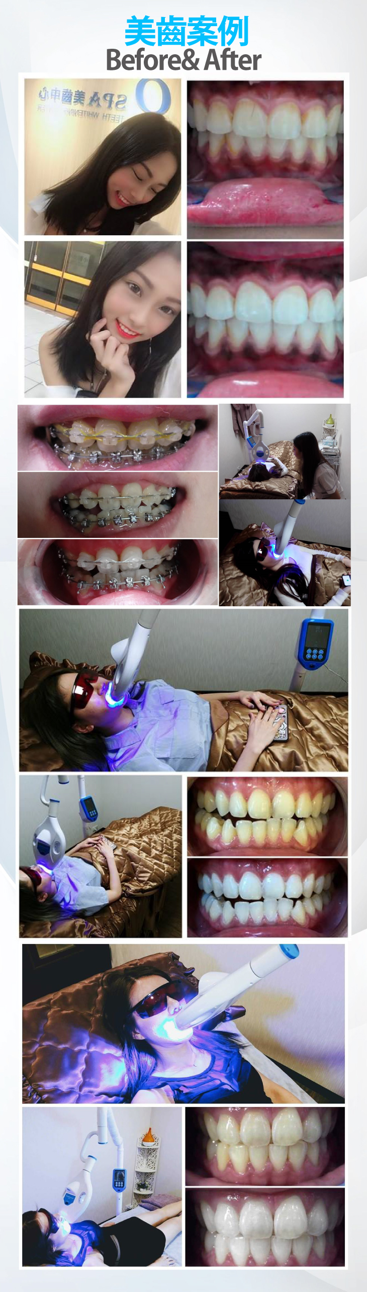 美齒去漬清汙亮白護理