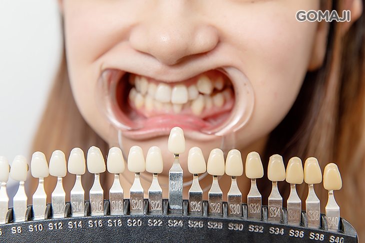 比對使用前色階