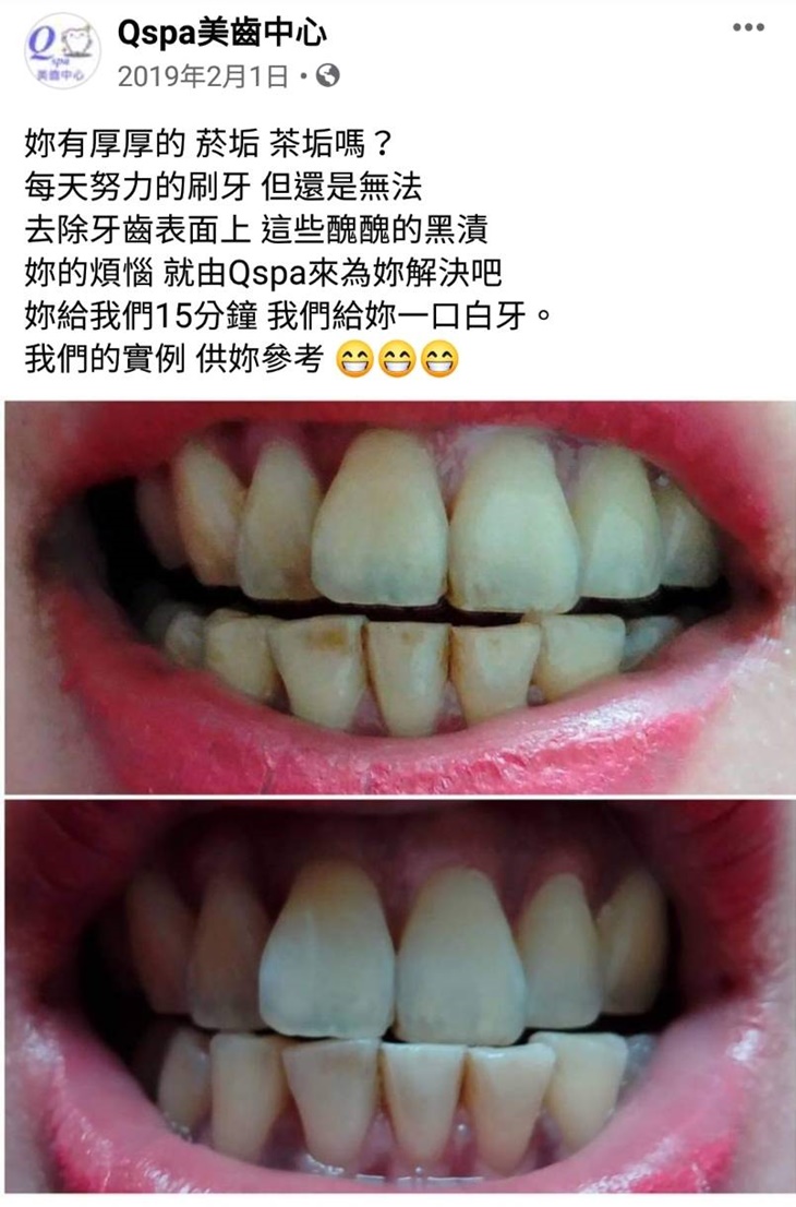 美齒去漬清汙亮白護理