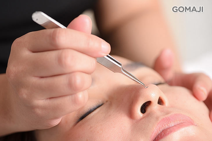 全臉粉刺痘痘淨化調理