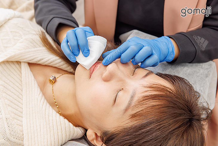 施作周圍肌膚殺菌清潔