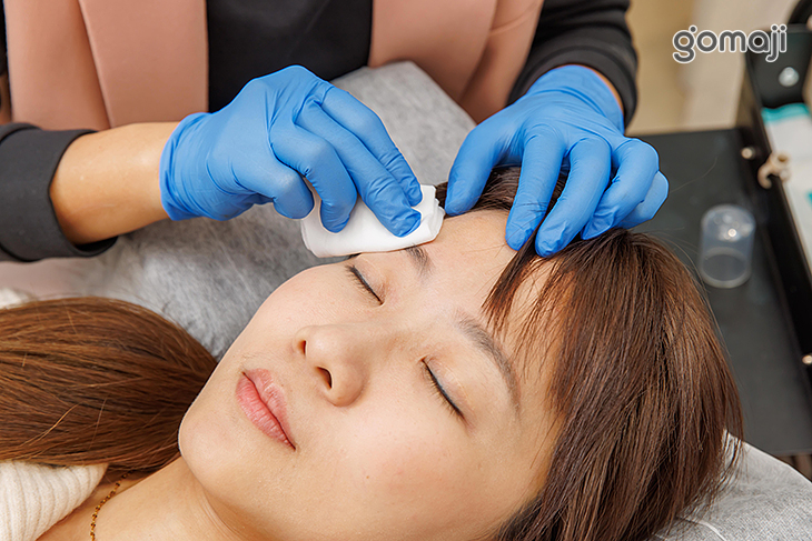 施作周圍肌膚殺菌清潔