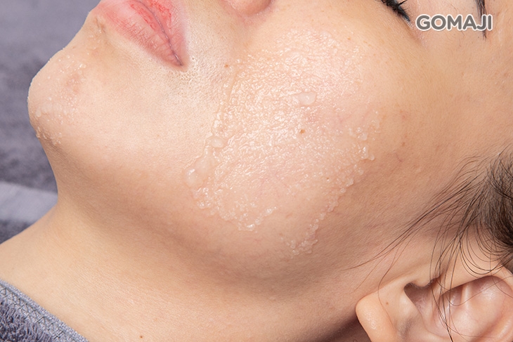 溫和酵素臉部去角質