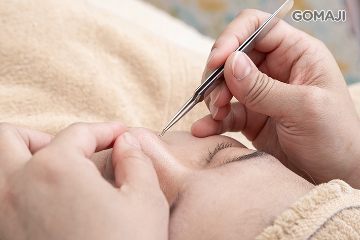 粉刺毛孔細緻清潔調理