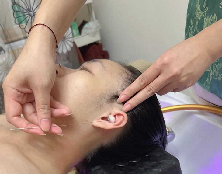耳垢清理