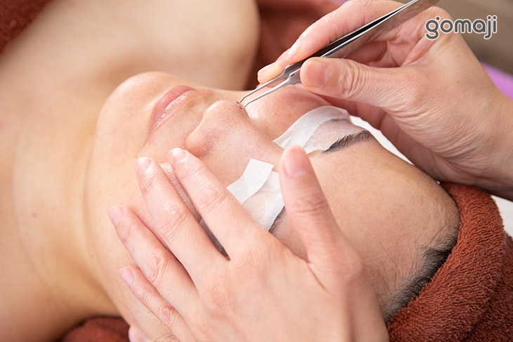 毛孔粉刺深層淨化