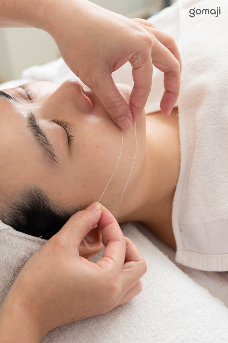 蠶絲膠原線拉提臉部線條