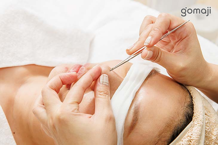 粉刺痘痘手工調理